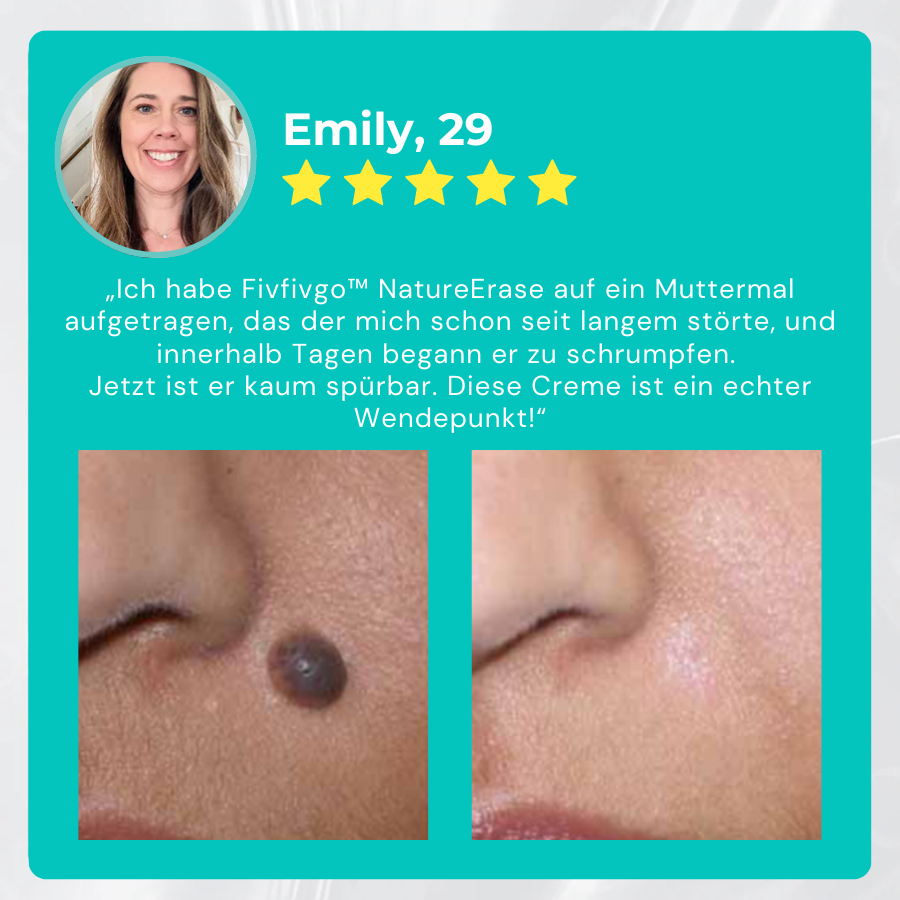 Fivfivgo® NatureErase Sofortige Maulwurf- und Fleckencreme