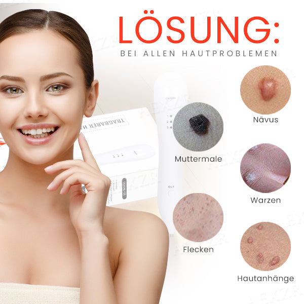 Fivfivgo™ Tragbarer Hautpflege-Laserstift