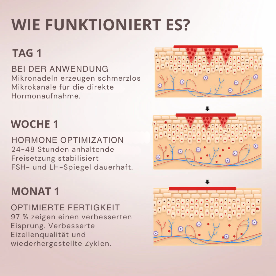 Oveallgo® FertiliPatch Mikronadeln Fruchtbarkeit Verbesserung System PRO