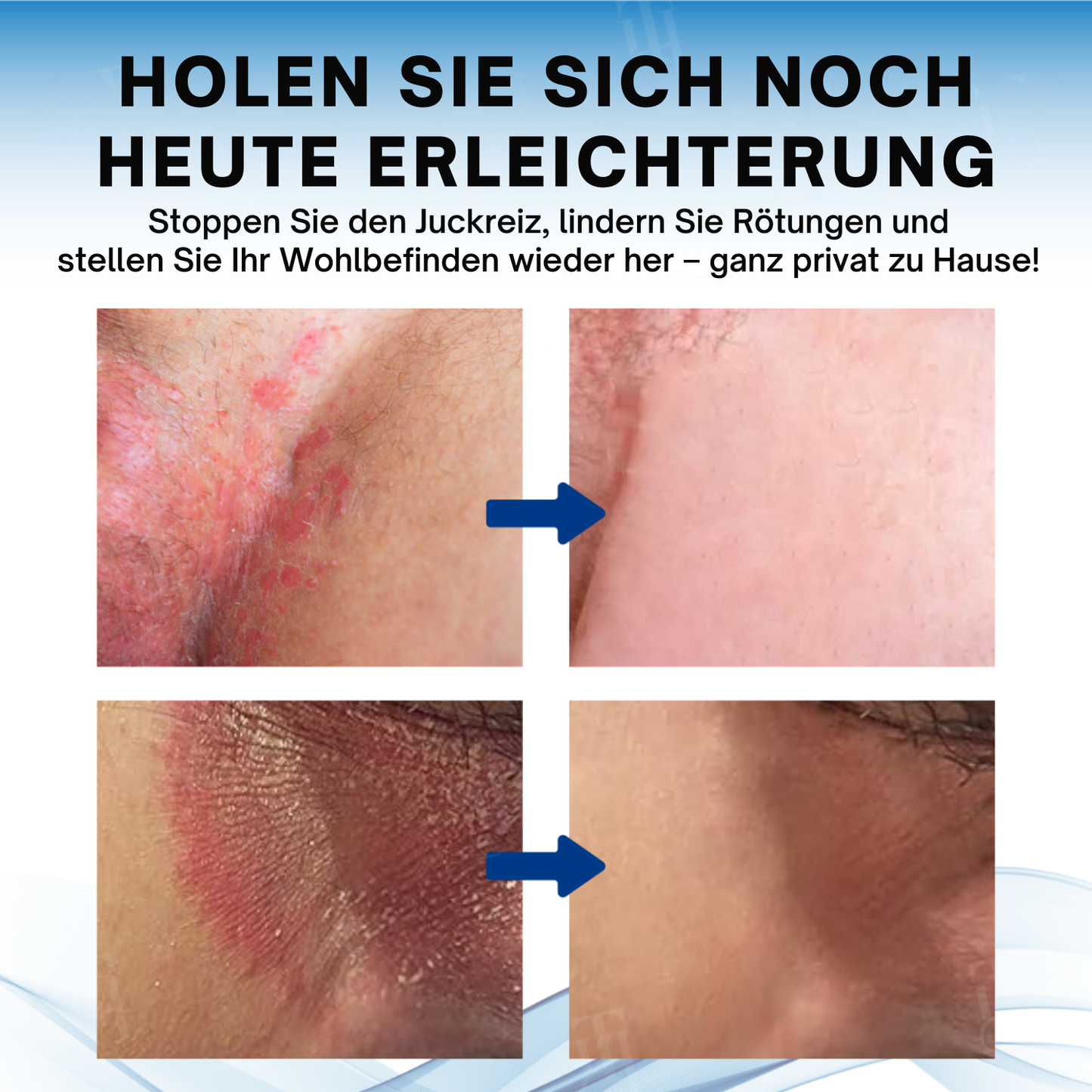 Fivfivgo® Hodensack juckt Behandlungscreme