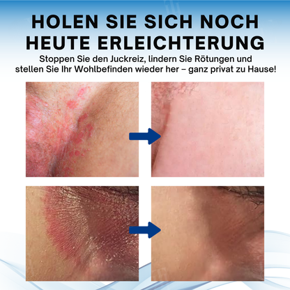 Fivfivgo® Hodensack juckt Behandlungscreme