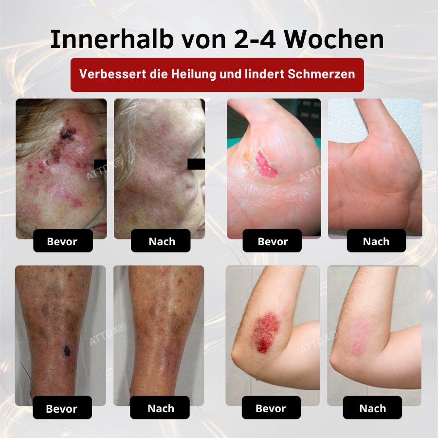 Cvreoz® GlucoseGuard Haut-Rettungs-Creme