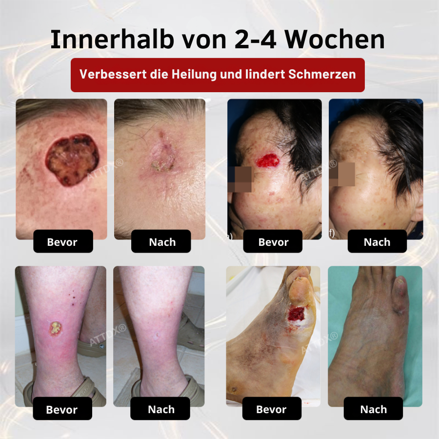 Cvreoz® GlucoseGuard Haut-Rettungs-Creme