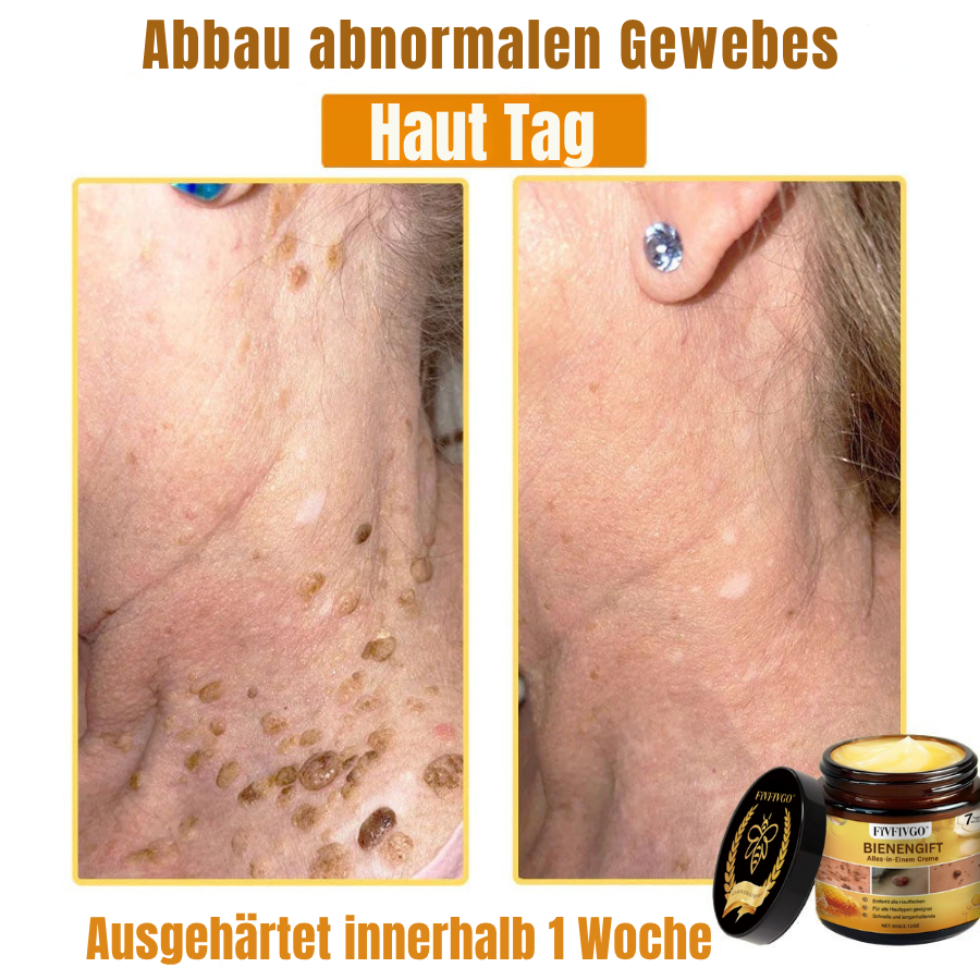 Fivfivgo® Bienengift Alles-in-Einem Creme