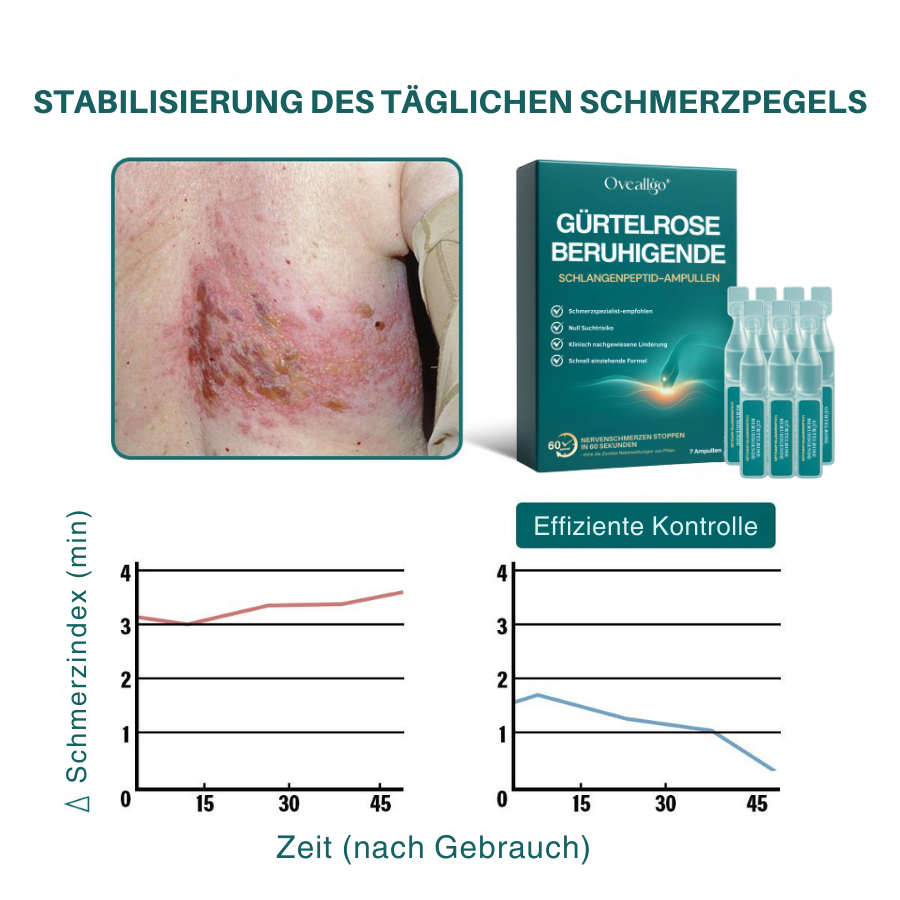 Oveallgo® Gürtelrose Beruhigende Schlangenpeptid-Ampullen