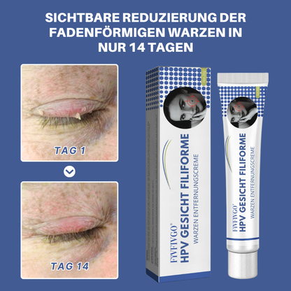 Fivfivgo® HPV Gesicht Filiforme Warzen Entfernungscreme