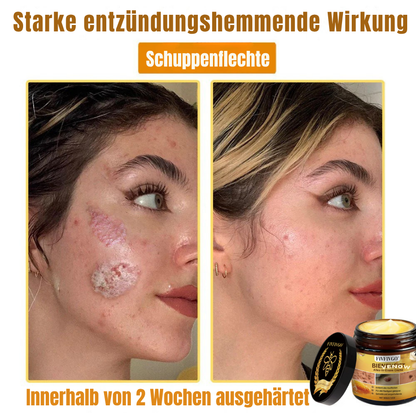 Fivfivgo® Bienengift Alles-in-Einem Creme