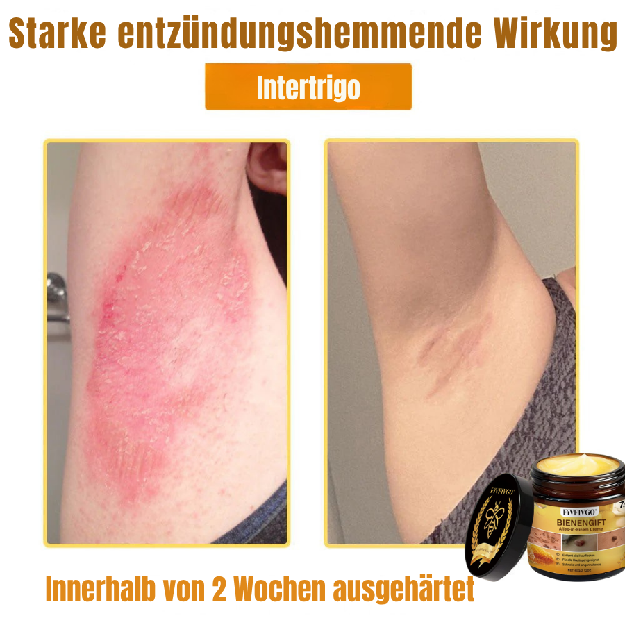Fivfivgo® Bienengift Alles-in-Einem Creme