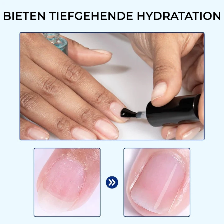 Cvreoz® OnyxoGuard Wachstum der Nägel und Reparaturserum