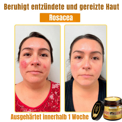 Fivfivgo® Bienengift Alles-in-Einem Creme