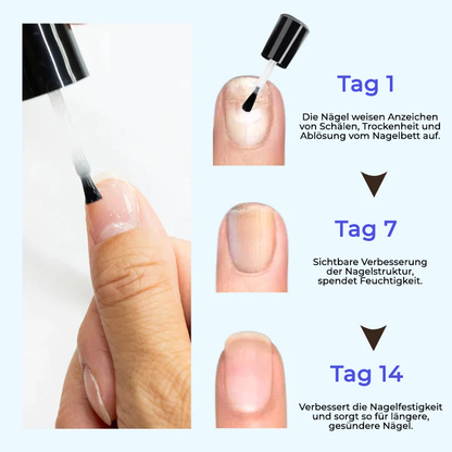 Cvreoz® OnyxoGuard Wachstum der Nägel und Reparaturserum