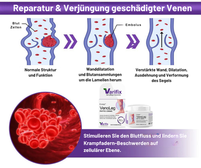 Cvreoz® VenoLeg Phyto Creme - Sichtbare Ergebnisse in nur 4 Tagen🔥