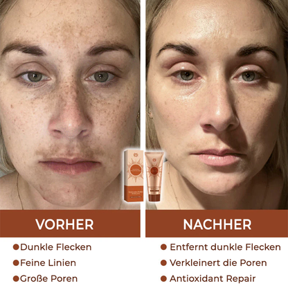 Fivfivgo® Herbal Spots Peel-Off-Gesichtsmaske