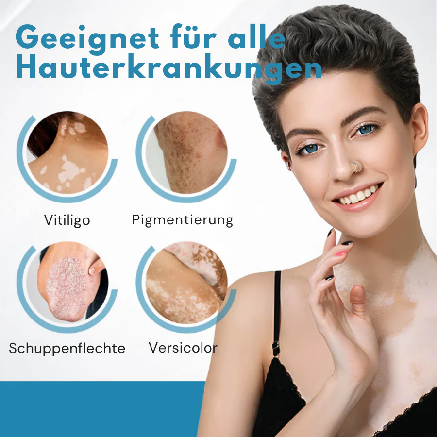 Bikenda® Vitiligo-Lichttherapiegerät