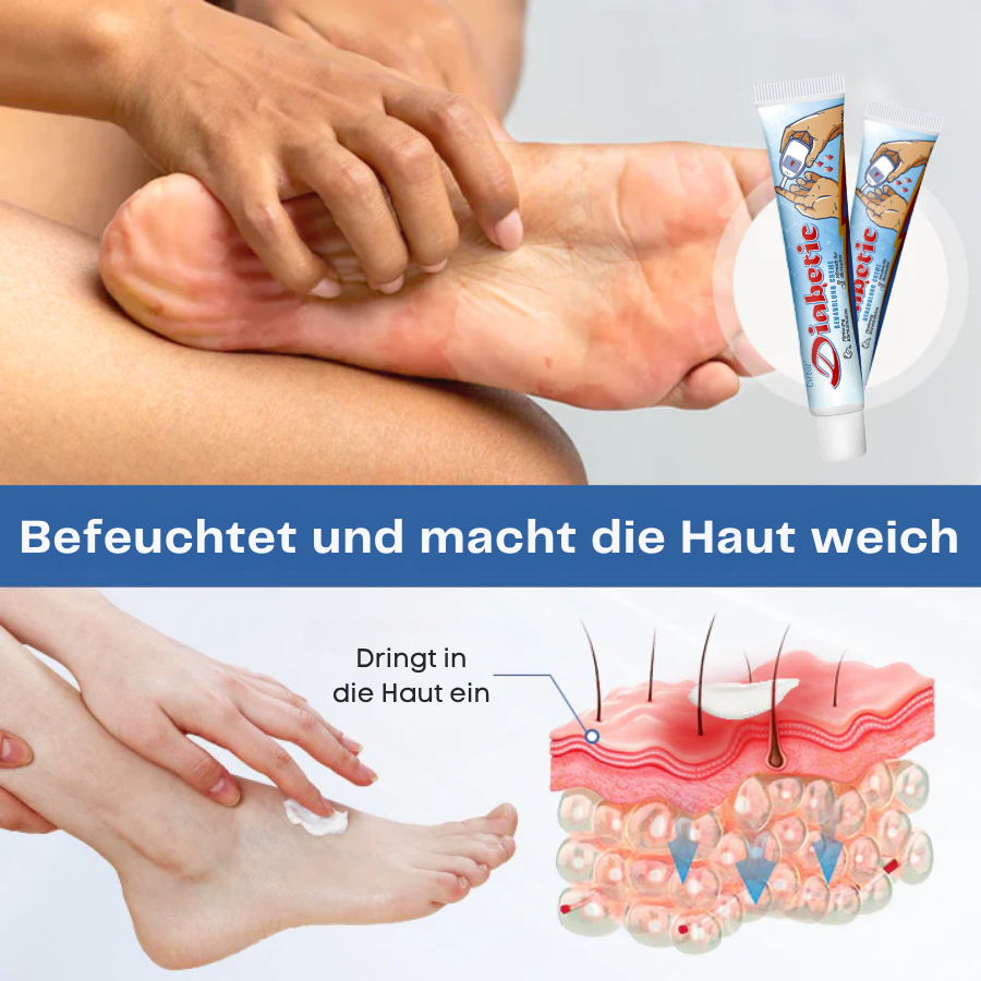 Cvreoz® VitaGluco Diabetes-Behandlung Creme