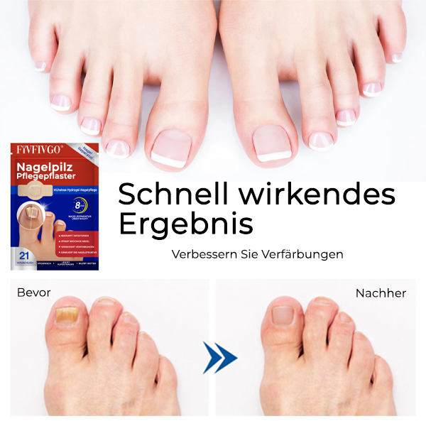 Fivfivgo® Nagelpilz Pflegepflaster