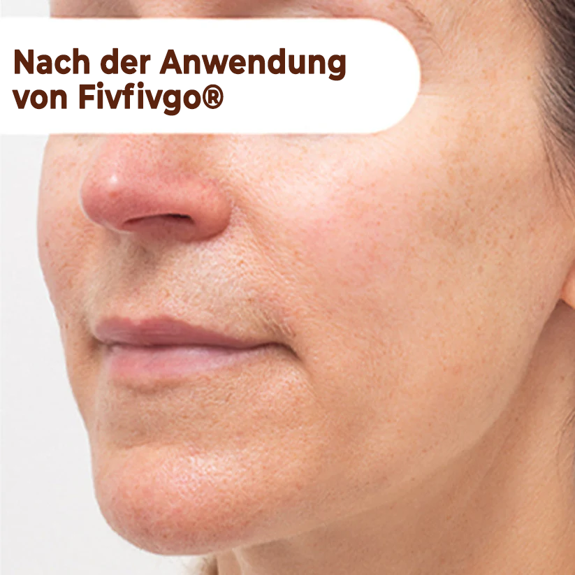 Fivfivgo® Herbal Spots Peel-Off-Gesichtsmaske