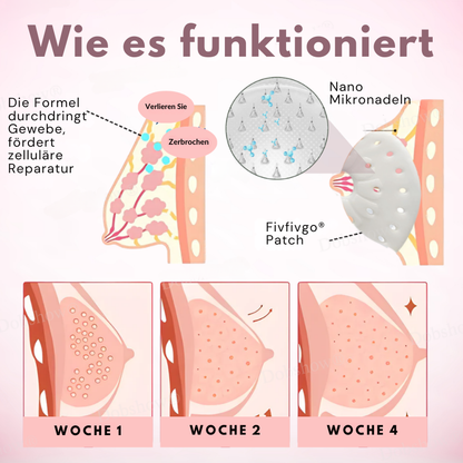 Fivfivgo® Brustvergrößerung-Nano-Aufnäher