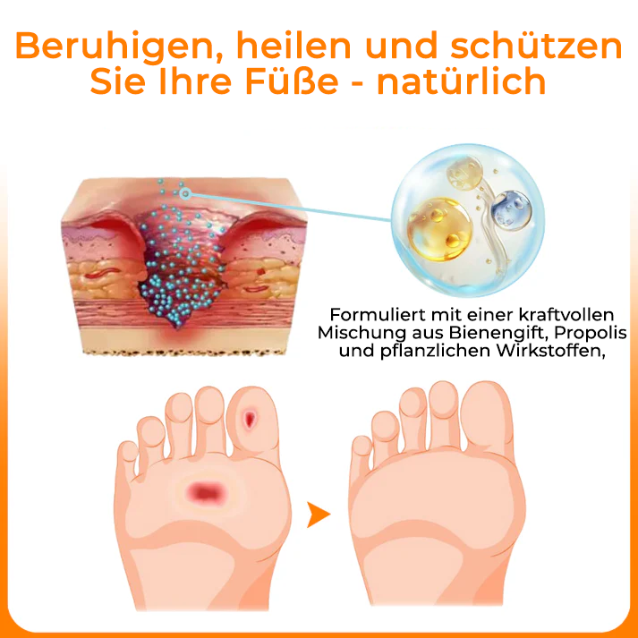 Cvreoz® VenHeal Bienengift Diabetiker-Wundspray