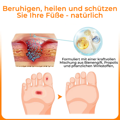 Cvreoz® VenHeal Bienengift Diabetiker-Wundspray