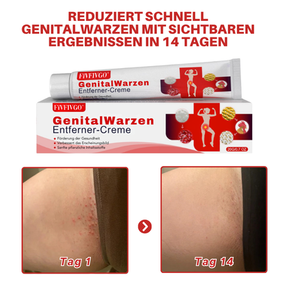 Fivfivgo® FloraGuard HPV Genitalwarzen-Entferner