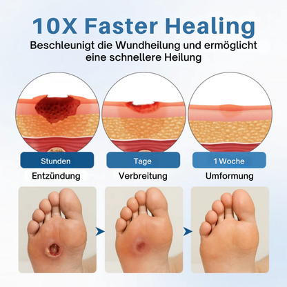 Fivfivgo® AngioVita Diabetiker-Pflegespray