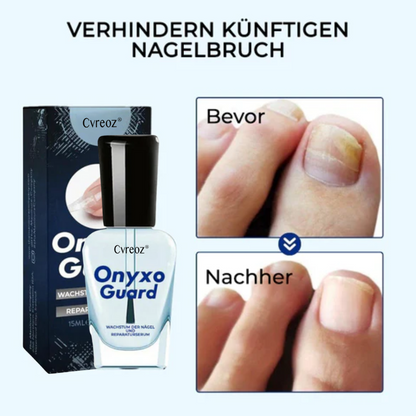 Cvreoz® OnyxoGuard Wachstum der Nägel und Reparaturserum