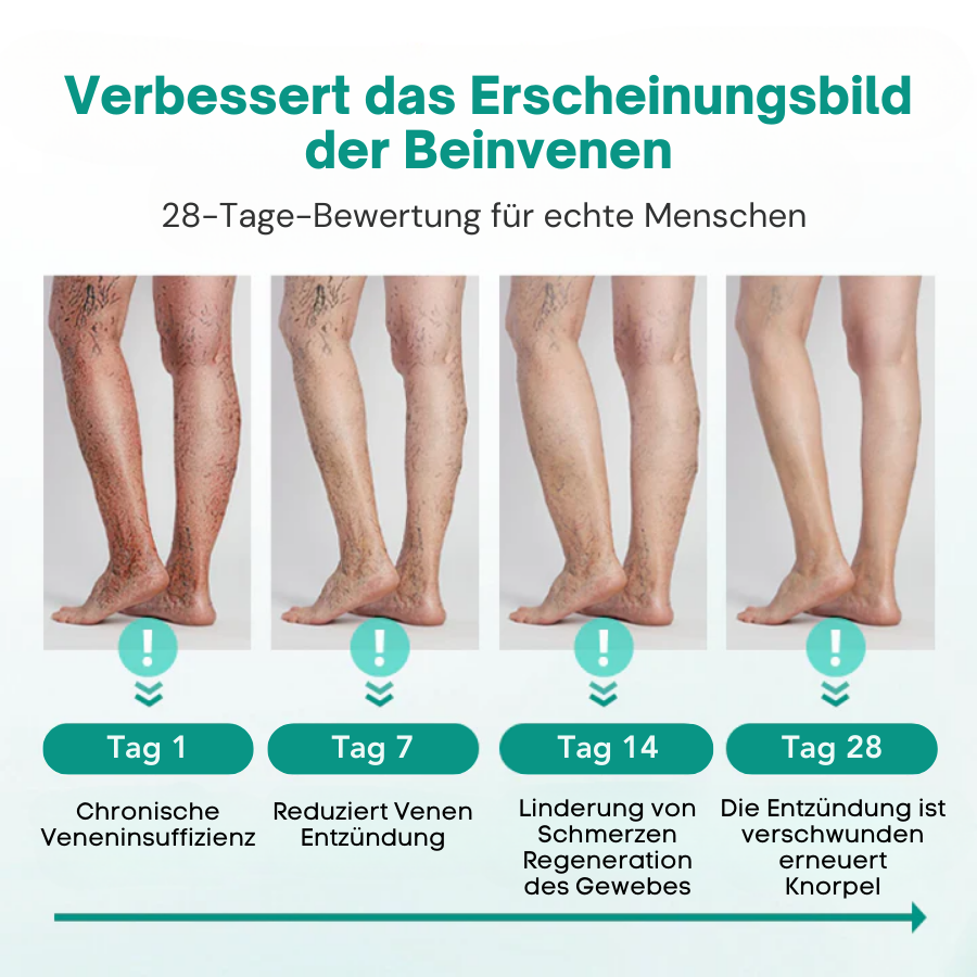 Cvreoz® LegRenew Krampfadern-Patch