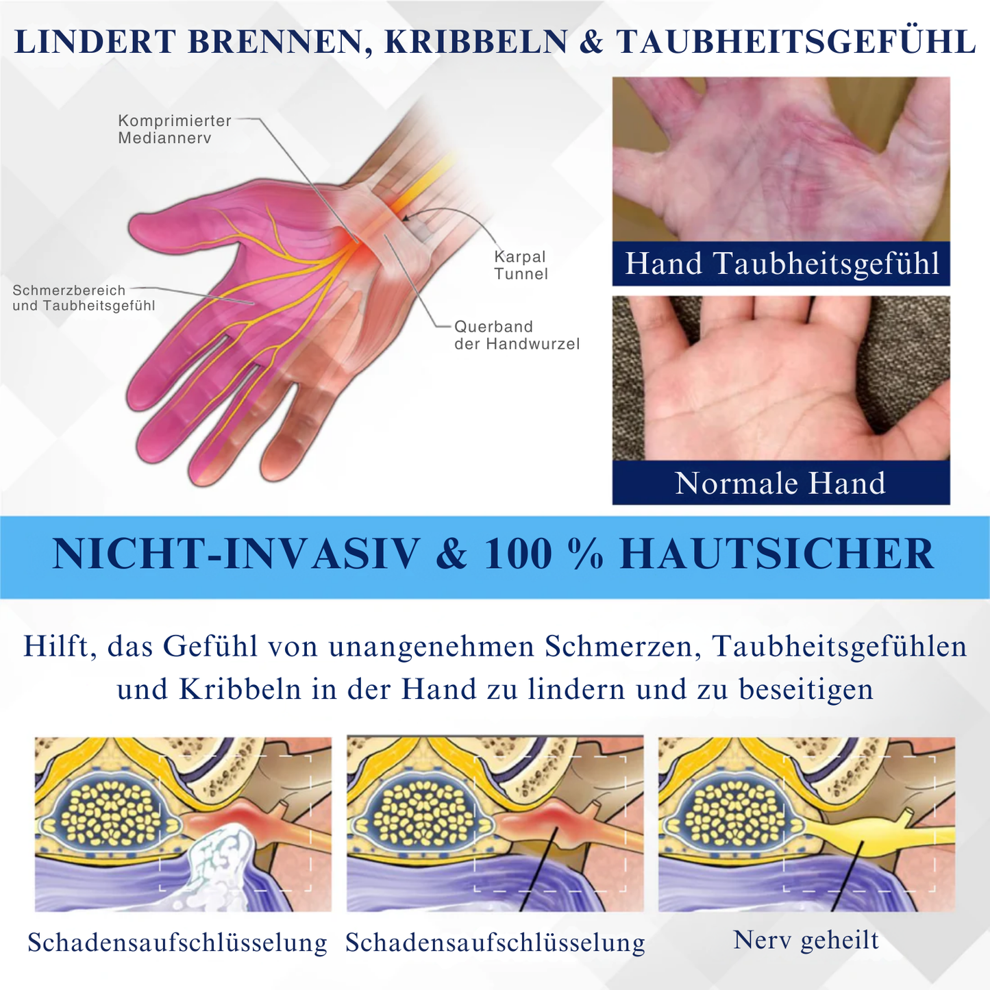 NovaRX® NervenentLastung LC Medizinische Behandlungscreme