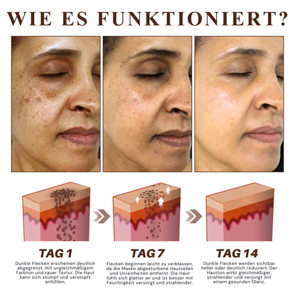 Fivfivgo® Kräuter Flecken Peel-Off-Gesichtsmaske