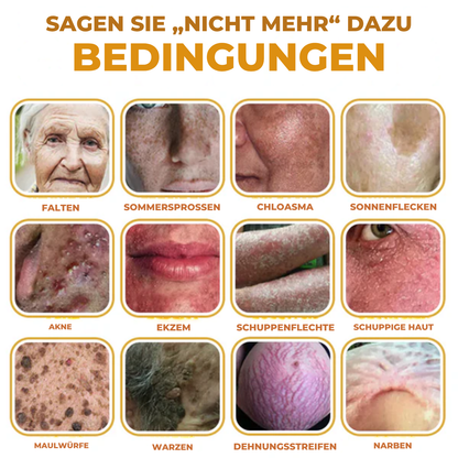 Fivfivgo® Bienengift Botanische Haut Tag Entfernung Patch 🇩🇪 Hergestellt in den Germany