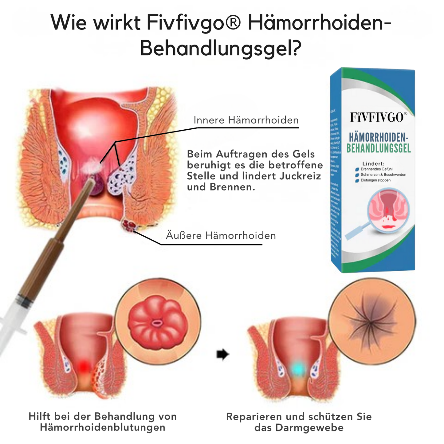 Fivfivgo® Gel zur Behandlung von Hämorrhoiden
