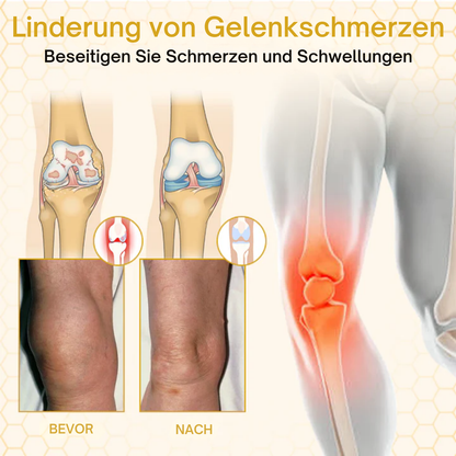 NovaRX® VenomFlex Bienentherapiecreme