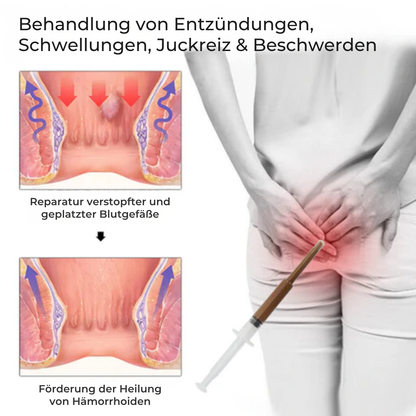 Fivfivgo® Gel zur Behandlung von Hämorrhoiden