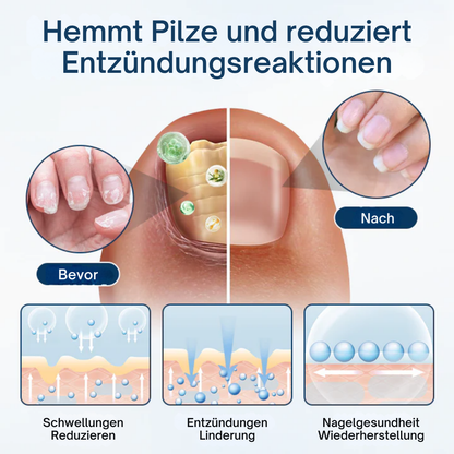 Fivfivgo® OnyxiGuard Pilzreparatur Kräuterspray