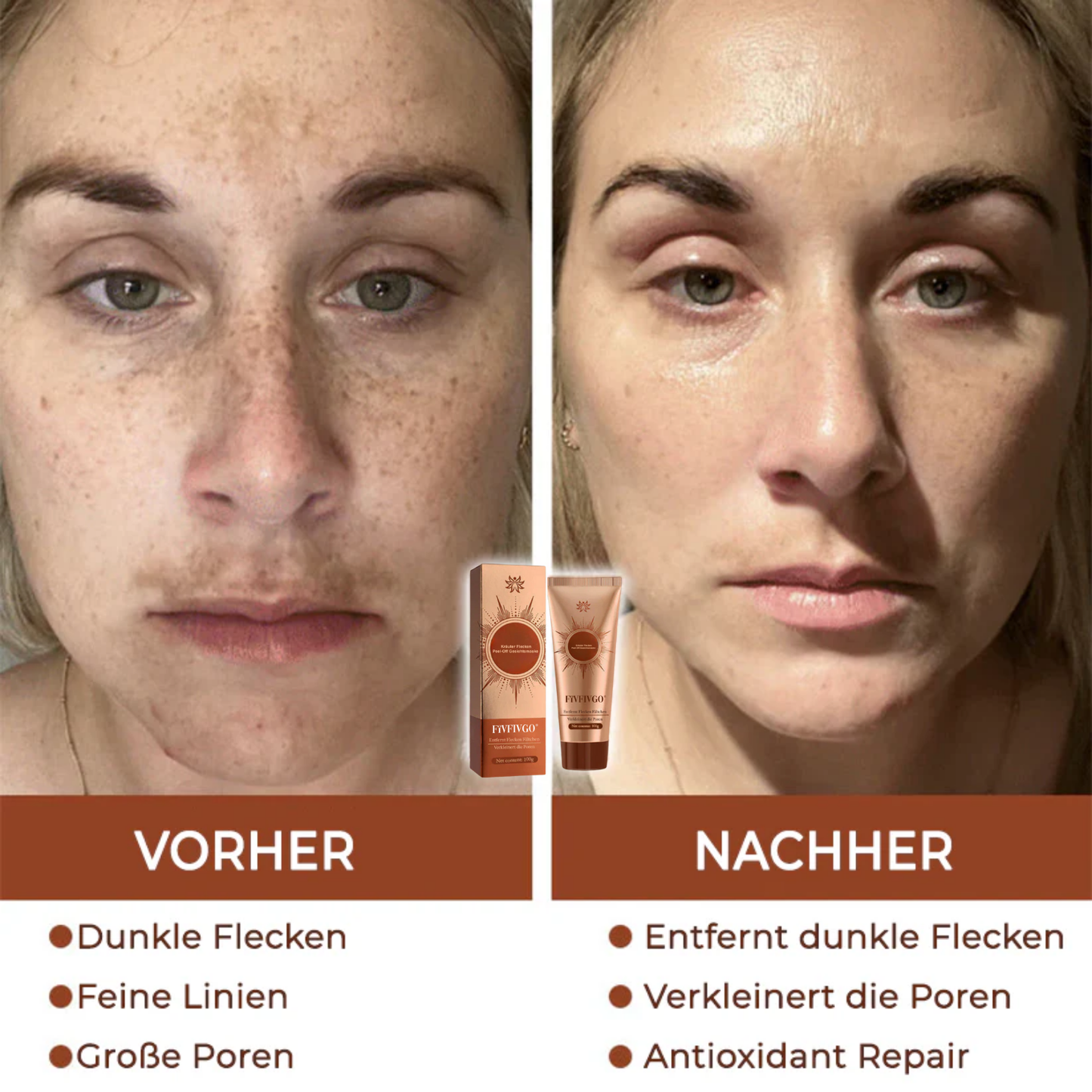 Fivfivgo® Kräuter Flecken Peel-Off-Gesichtsmaske
