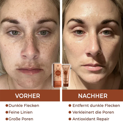 Fivfivgo® Kräuter Flecken Peel-Off-Gesichtsmaske