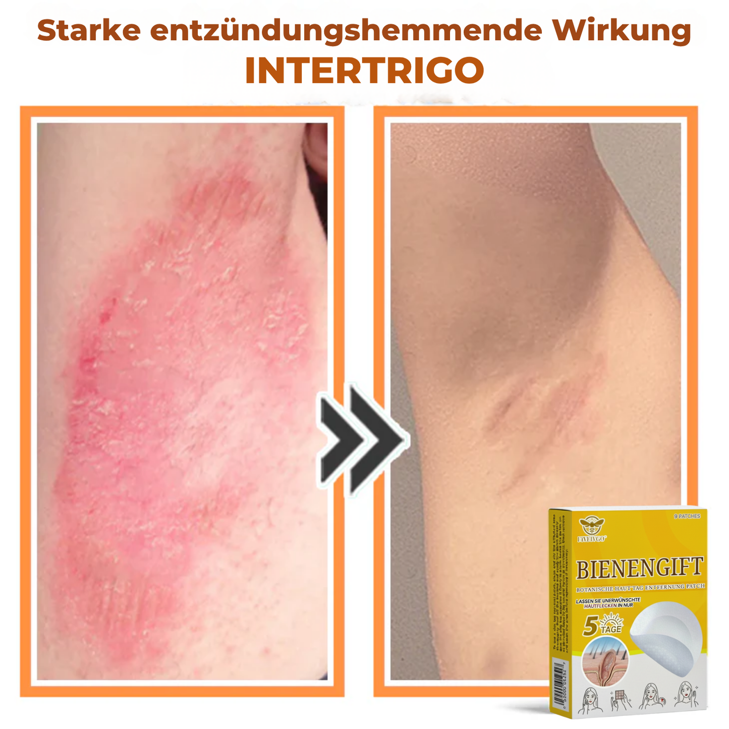 Fivfivgo® Bienengift Botanische Haut Tag Entfernung Patch 🇩🇪 Hergestellt in den Germany