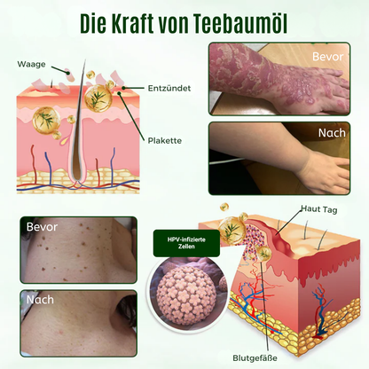 Fivfivgo® DermaPure Teebaum-Heilcreme