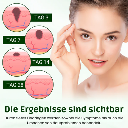 Fivfivgo® DermaPure Teebaum-Heilcreme