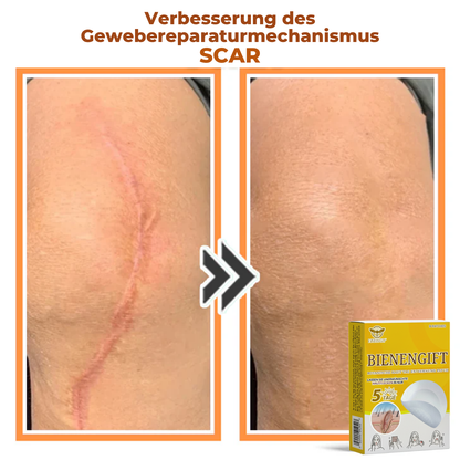 Fivfivgo® Bienengift Botanische Haut Tag Entfernung Patch 🇩🇪 Hergestellt in den Germany