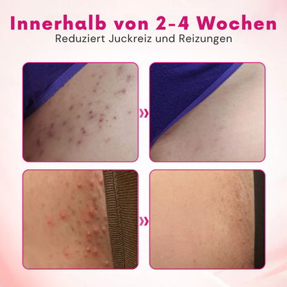 Fivfivgo® IntiDefend Anti-HPV-Interferon das Gel