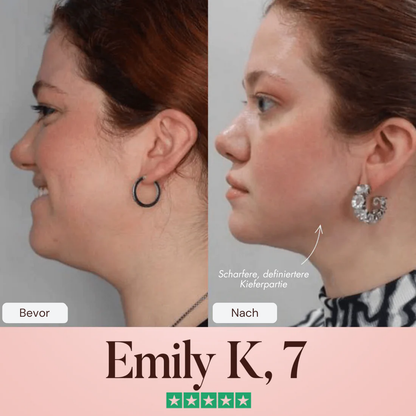 Oveallgo® SculptFix Maske Infundiert mit Retinol und Kollagen um Ihre beste Kieferpartie zu enthüllen