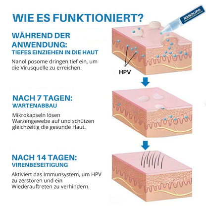 Oveallgo® Nanolipo Genital Warzen Klinische Ampullen PRO
