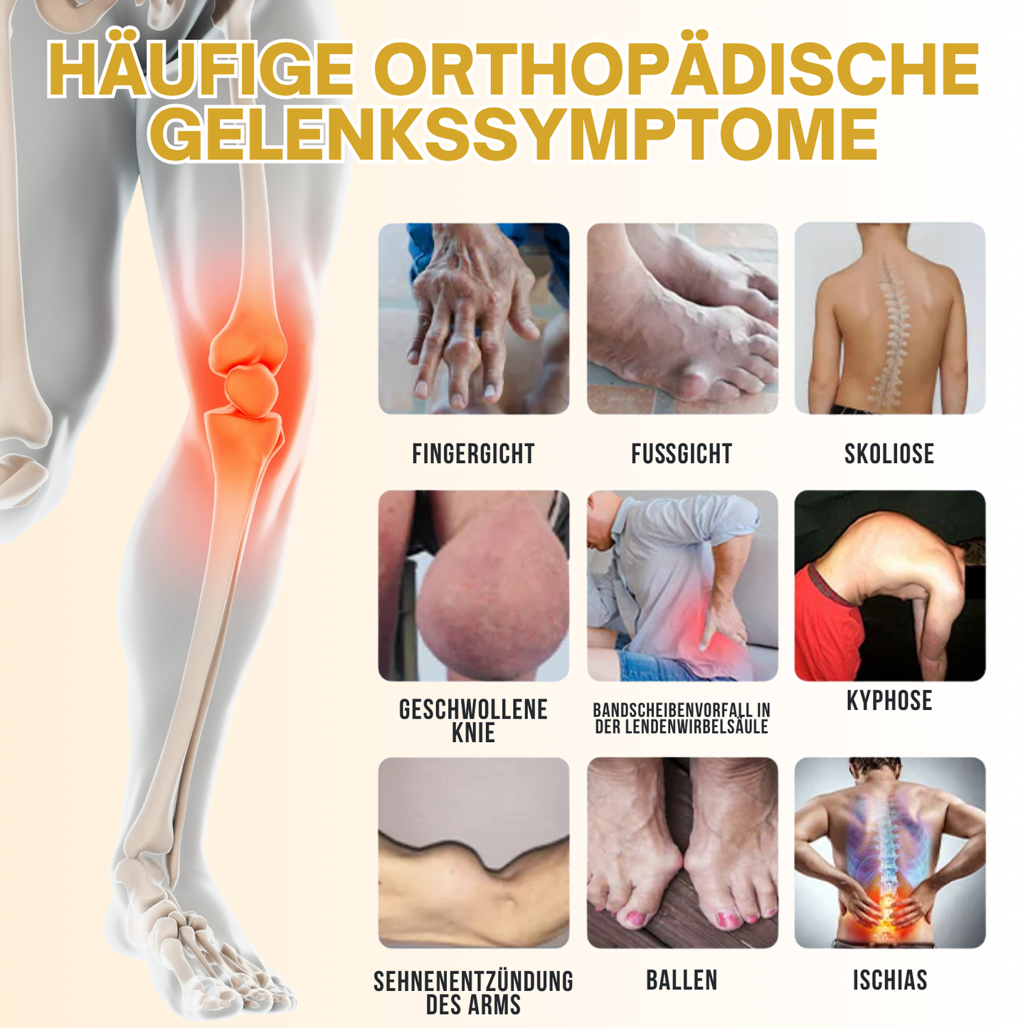 NovaRX® VenomFlex Bienentherapiecreme