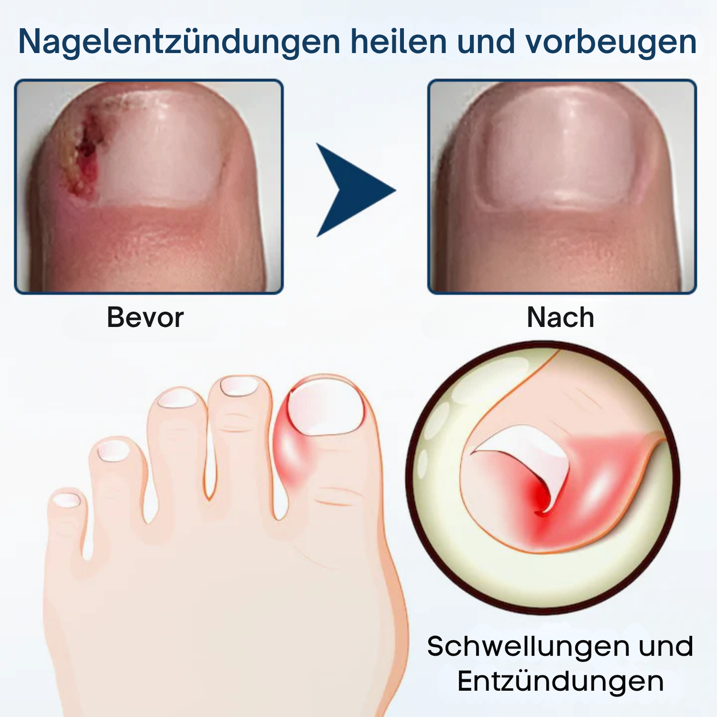 Fivfivgo® OnyxiGuard Pilzreparatur Kräuterspray