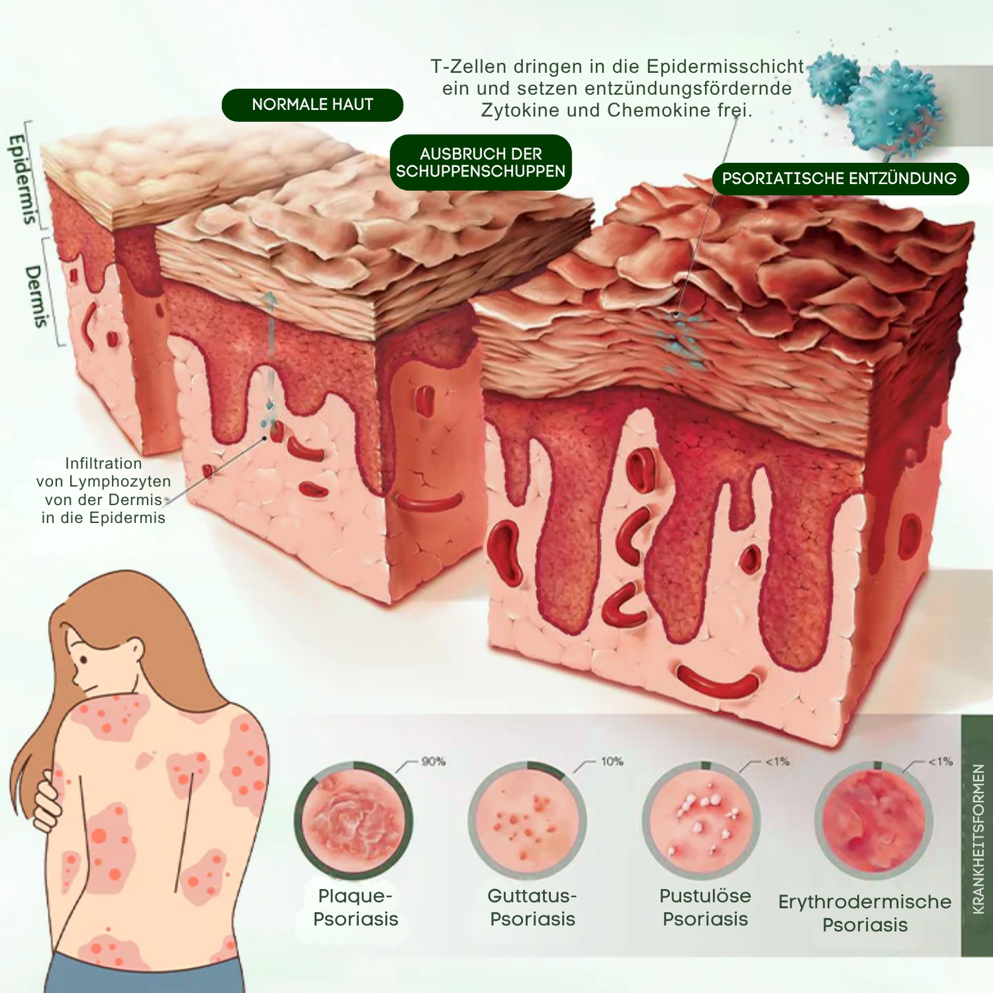 Fivfivgo® DermaPure Teebaum-Heilcreme