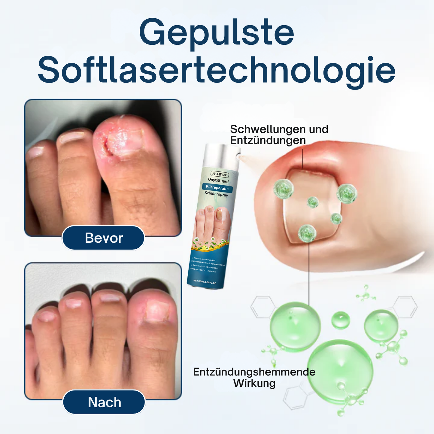 Fivfivgo® OnyxiGuard Pilzreparatur Kräuterspray