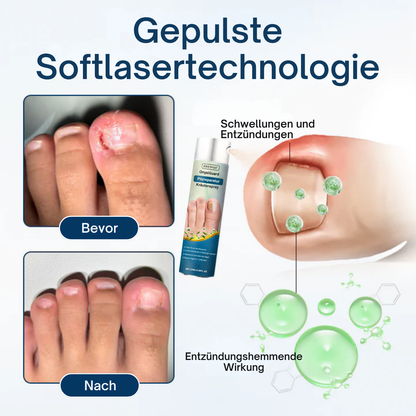 Fivfivgo® OnyxiGuard Pilzreparatur Kräuterspray