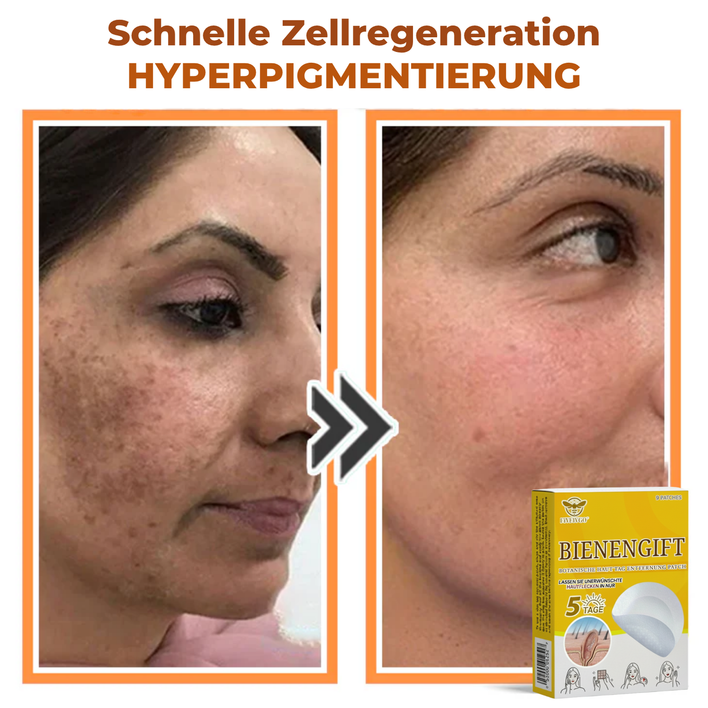 Fivfivgo® Bienengift Botanische Haut Tag Entfernung Patch 🇩🇪 Hergestellt in den Germany